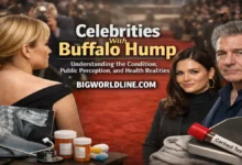 Celebrities With Buffalo Hump: Understanding the Condition, Public Perception, and Health Realities 4 Celebrities With Buffalo Hump